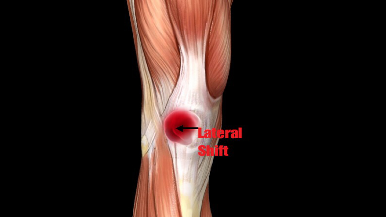 どのような症状がありますか?